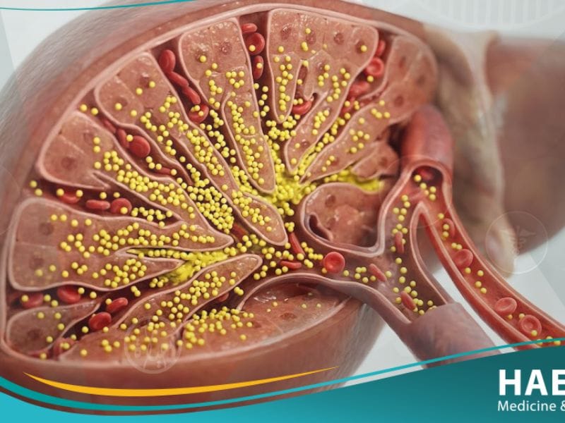 يرقان الوليد