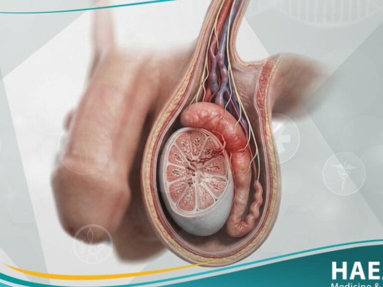 ألم خصوي (3)