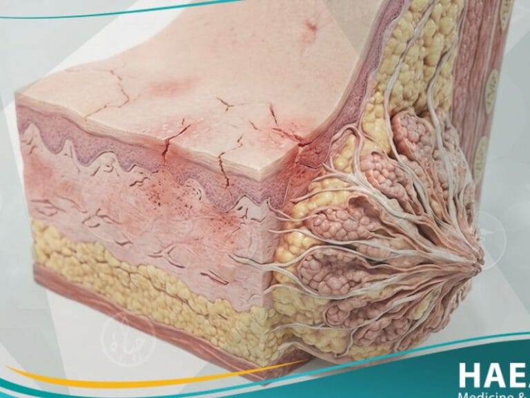 الحلمات المتصدعة