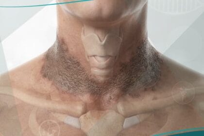 _بلاغرة