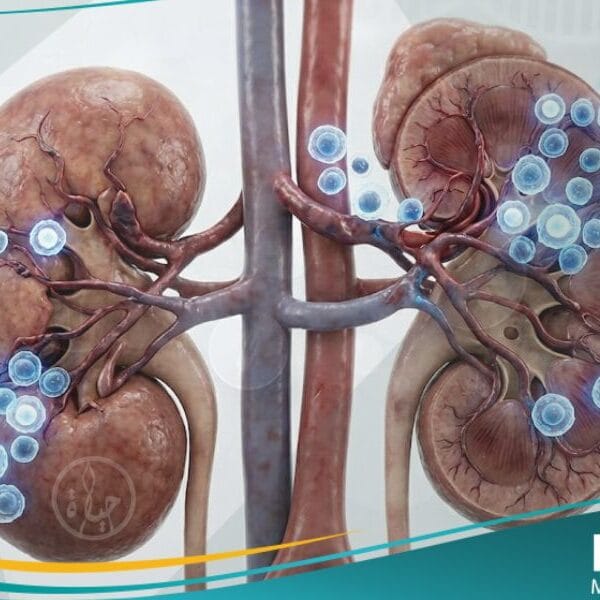 رفض الأعضاء المزروعة