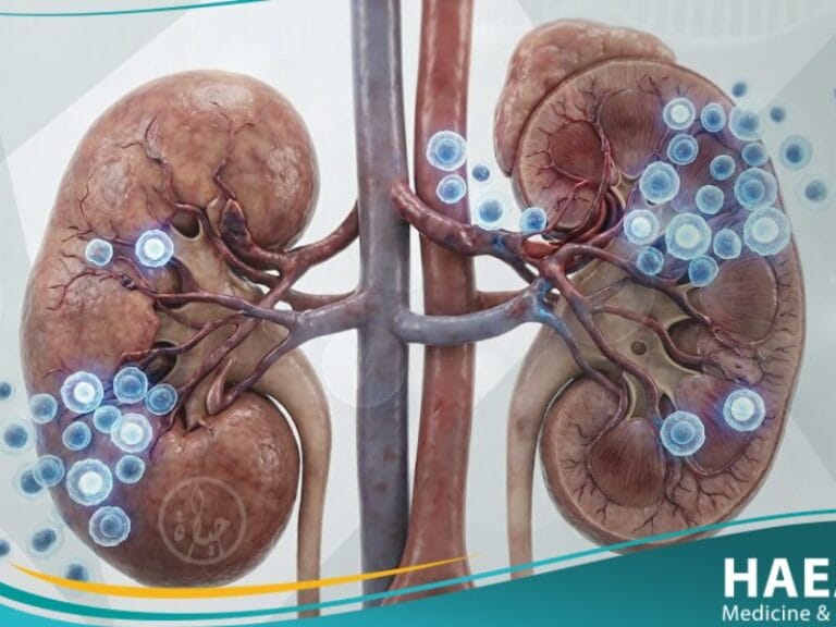 رفض الأعضاء المزروعة