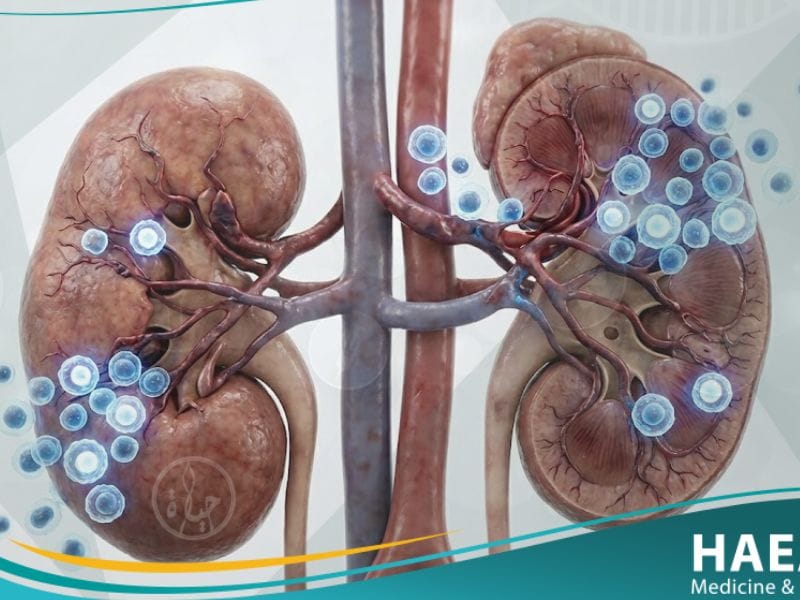 رفض الأعضاء المزروعة