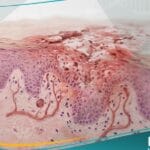 _طفح الحفاظ (1)