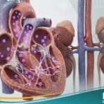 _فرط بوتاسيوم الدم