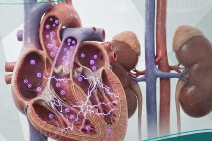_فرط بوتاسيوم الدم