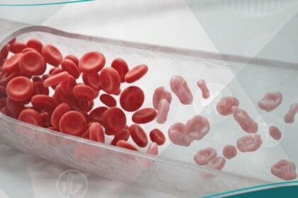 فقر الدم