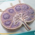 ورم لمفي