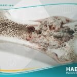 ساركوما العظام