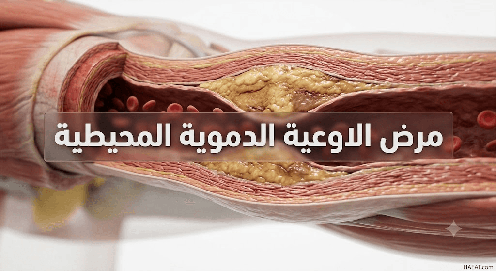 مرض الاوعية الدموية المحيطية | 6 أعراض، تشخيص، وعلاج 20 image 255