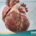 أم الدم البطينية اليسرى (1)