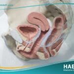 ترميم المهبل (2)