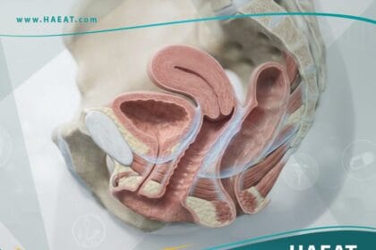 ترميم المهبل (2)