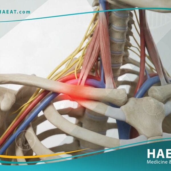 متلازمة مخرج الصدر (1)