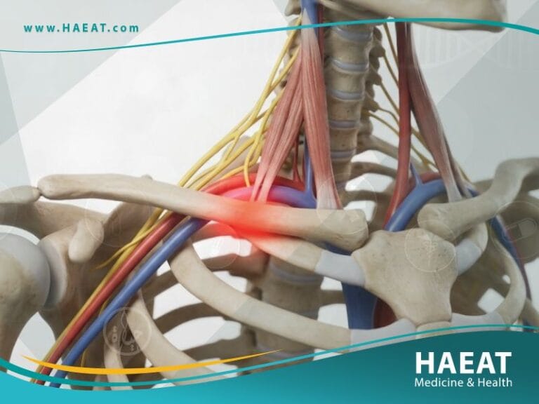 متلازمة مخرج الصدر (1)