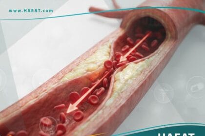مرض الاوعية الدموية المحيطية