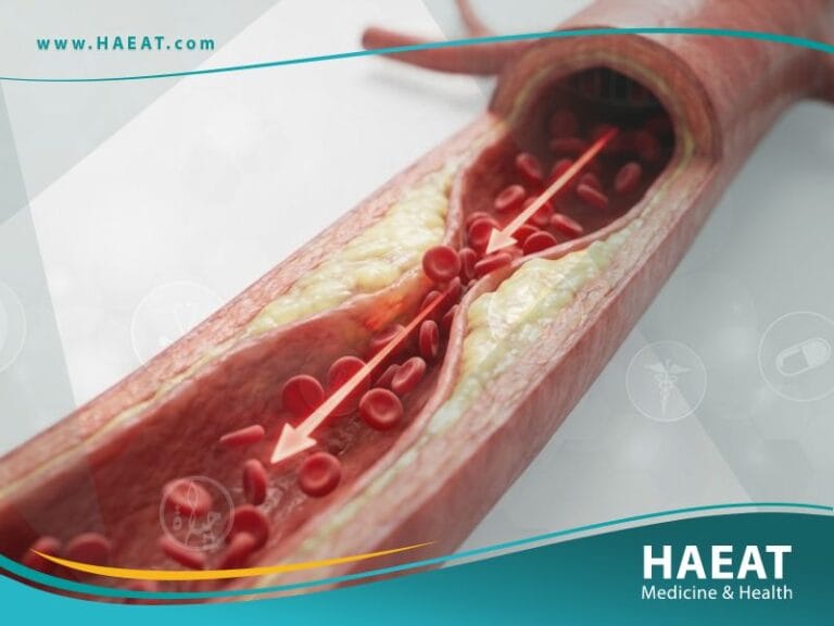 مرض الاوعية الدموية المحيطية