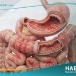 _التهاب المعدة والأمعاء