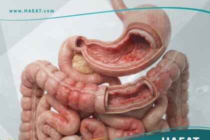 _التهاب المعدة والأمعاء